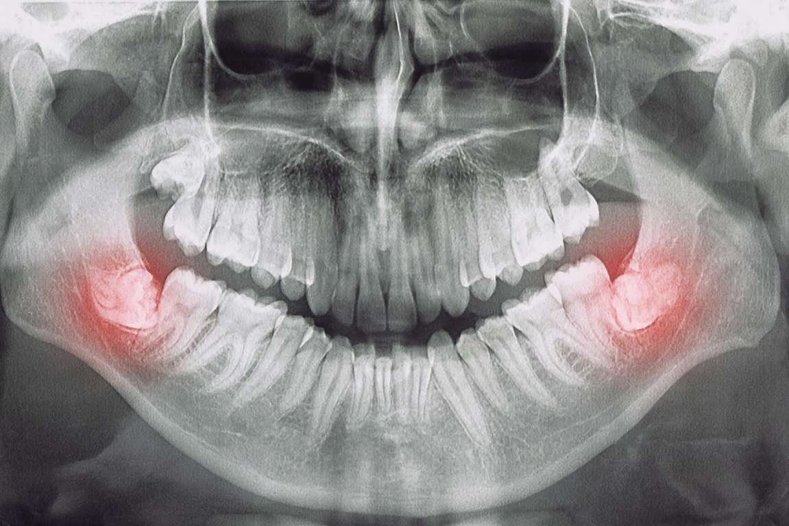 chirurgia odontostomatologica