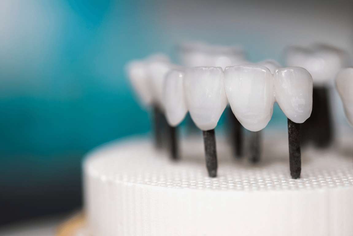 zirconia dentale