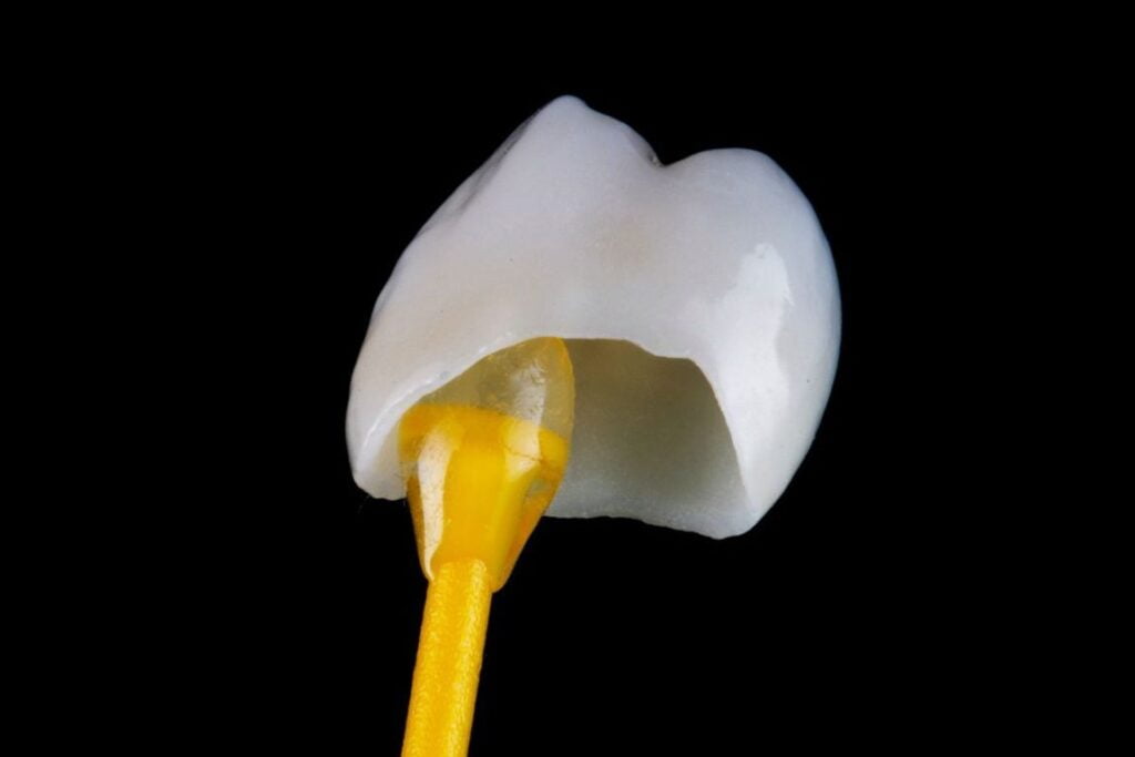capsula sdentale