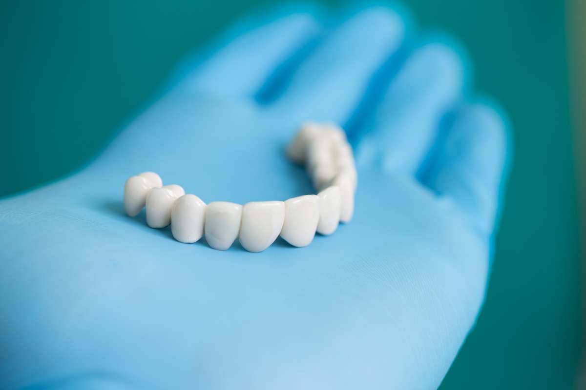 Implantologia - Come prendersi cura degli impianti